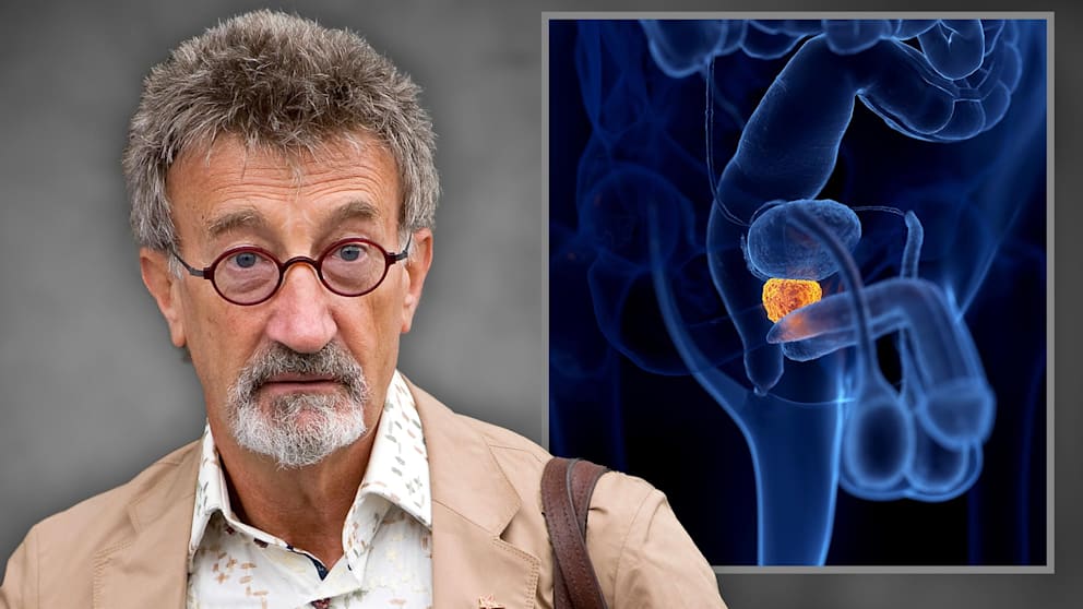 Da sich die Symptome von Prostatakrebs meist sehr spät zeigen, eine vollständige Heilungschance aber nur im Frühstadium gegeben ist, sollten Männer unbedingt regelmäßig zur Vorsorge gehen