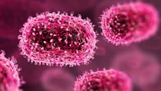Erster Mpox-Fall in Deutschland: RKI bestätigt Affenpocken