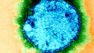 Zahl der Hantavirus-Fälle in Bayern verdreifacht